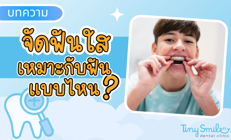 SEO Tiny Smile 1400 x 850 (16)