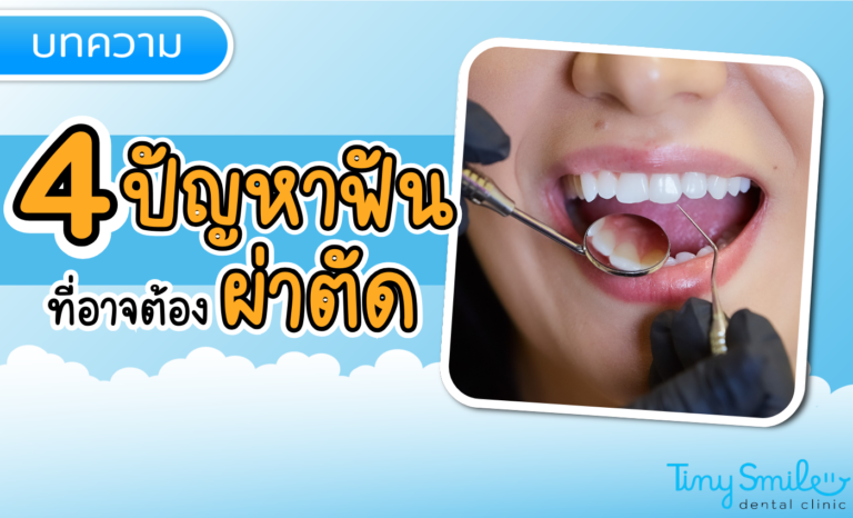 SEO Tiny Smile 1400 x 850 (17)