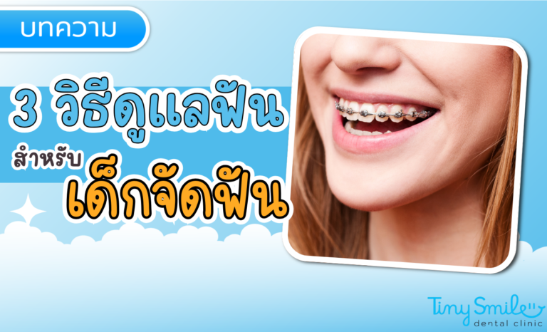 SEO Tiny Smile 1400 x 850 (40)