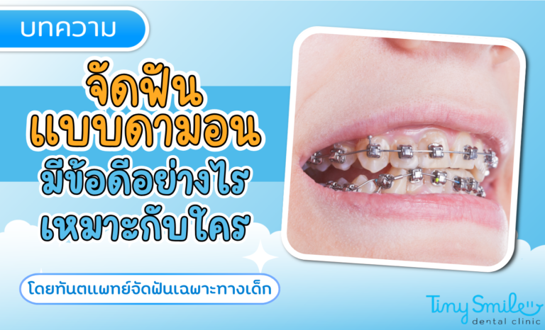 SEO Tiny Smile 1400 x 850 (69)
