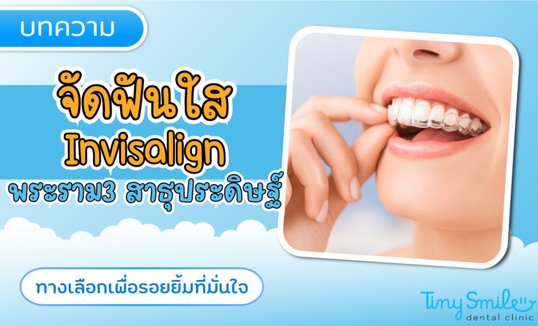 SEO Tiny Smile 1400 x 850 (74)