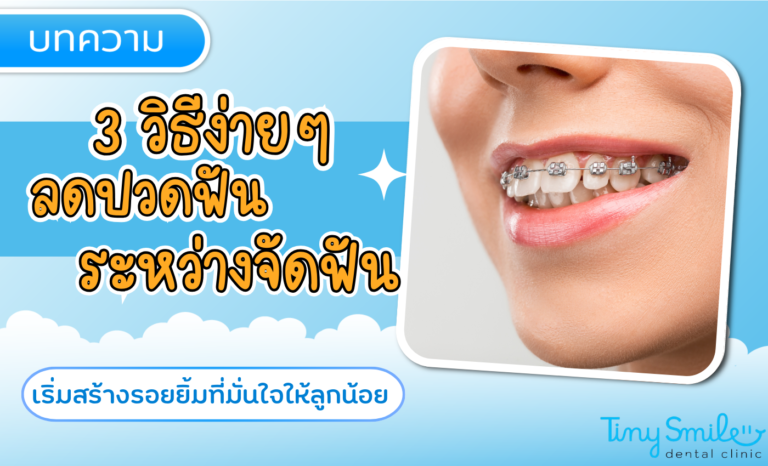 SEO Tiny Smile 1400 x 850 - 2025-03-20T153307