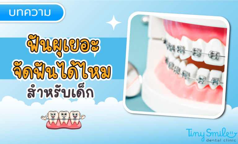 SEO Tiny Smile 1400 x 850 - 2025-03-21T135044