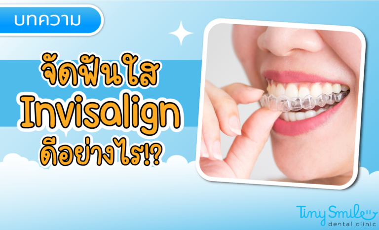SEO Tiny Smile 1400 x 850 - 2025-03-27T154913
