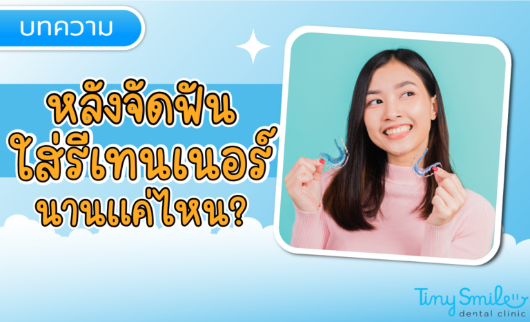 SEO Tiny Smile 1400 x 850 - 2025-03-27T155251
