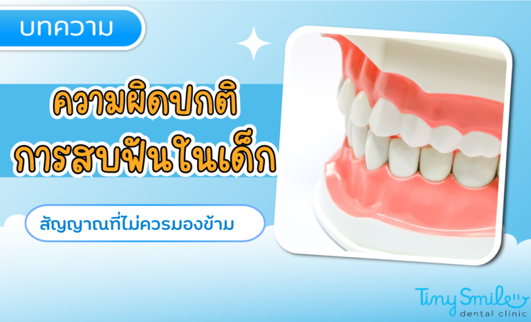 SEO Tiny Smile 1400 x 850 - 2025-03-31T113104