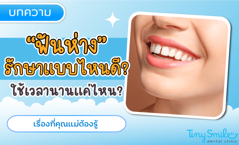 SEO Tiny Smile 1400 x 850 - 2025-03-31T130641