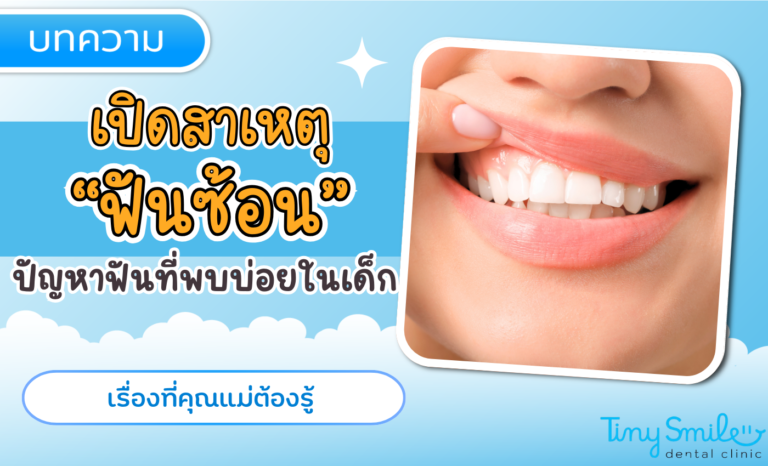 SEO Tiny Smile 1400 x 850 - 2025-03-31T132251