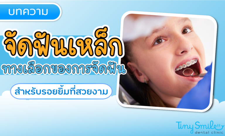 SEO Tiny Smile 1400 x 850 (87)