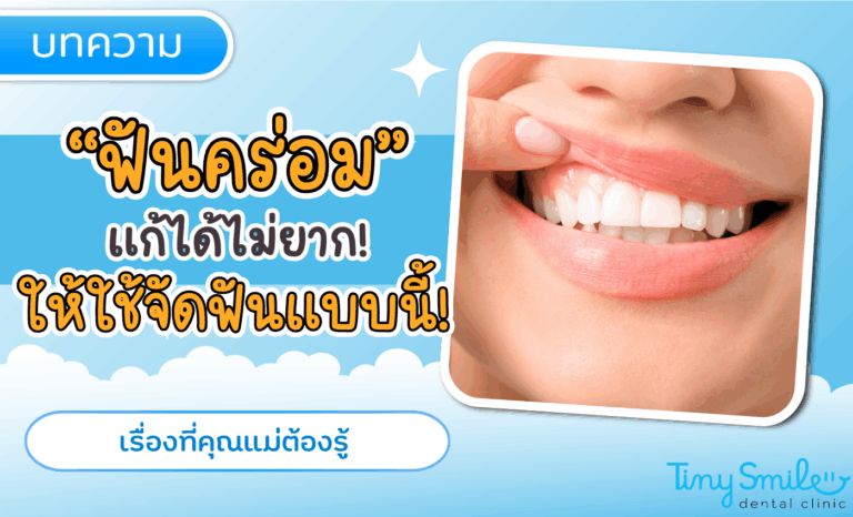 SEO Tiny Smile 1400 x 850 - 2025-04-17T162340