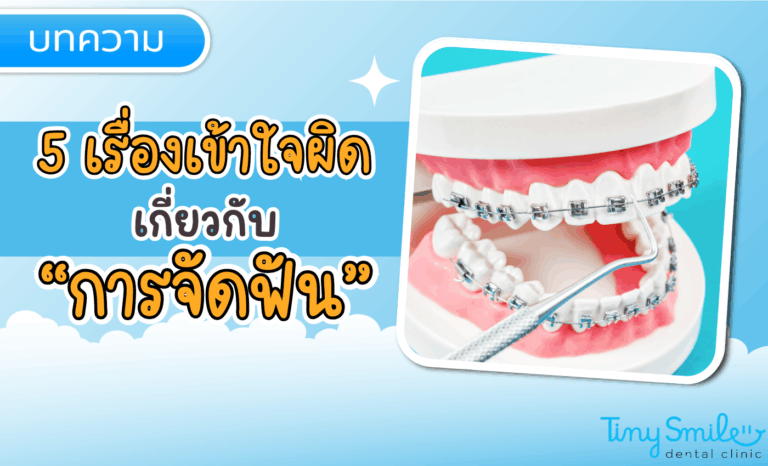 SEO Tiny Smile 1400 x 850 - 2025-04-21T143153