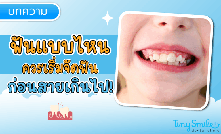 SEO Tiny Smile 1400 x 850 - 2025-05-13T155221