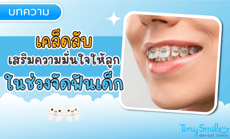 SEO Tiny Smile 1400 x 850 - 2025-05-24T131934