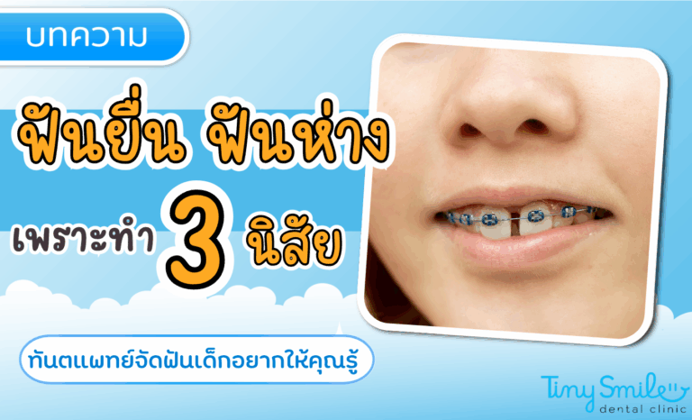 3 นิสัยทำแล้วฟันยื่น ฟันห่าง ที่ทันตแพทย์จัดฟันเด็กอยากให้คุณรู้