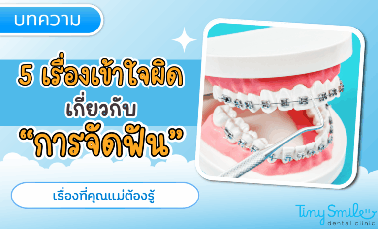 5 เรื่องเข้าใจผิด เกี่ยวกับการจัดฟัน ที่คุณแม่ไม่ควรมองข้าม