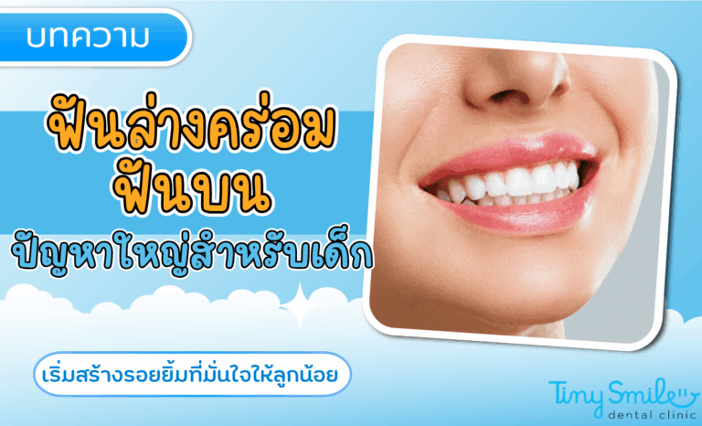ฟันล่างคร่อมฟันบน ปัญหาใหญ่สำหรับเด็ก