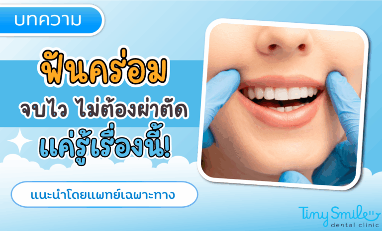 แก้ฟันคร่อมในเด็ก จบไว ไม่ต้องผ่าตัด แค่รู้เรื่องนี้!