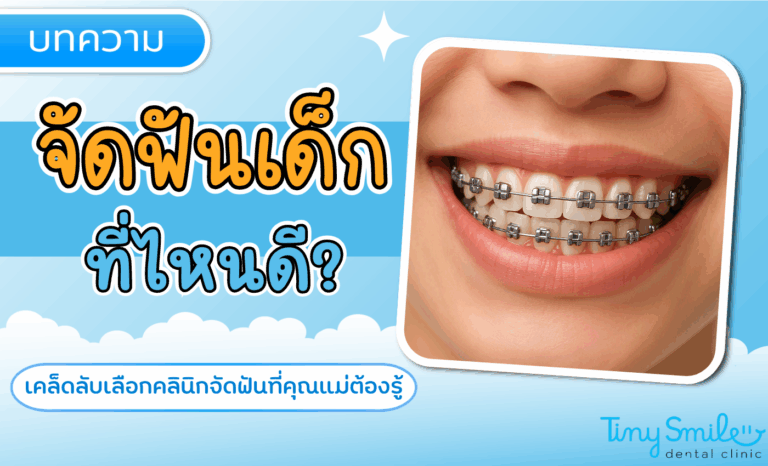 จัดฟันเด็ก กับหมอเฉพาะทางจัดฟันเด็ก ทำไมต้องเลือกคลินิกทันตกรรมที่เข้าใจเด็กจริงๆ