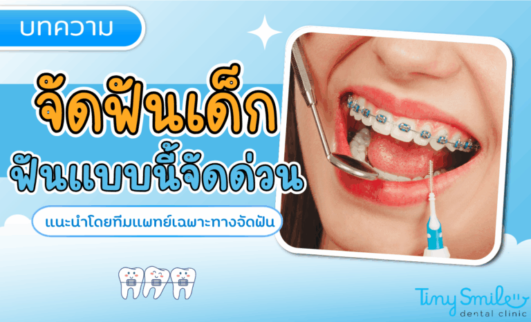 เคสยอดฮิตจัดฟันเด็ก ฟันเก ฟันซ้อน ฟันยื่น – วิธีจัดการโดยหมอเฉพาะทาง