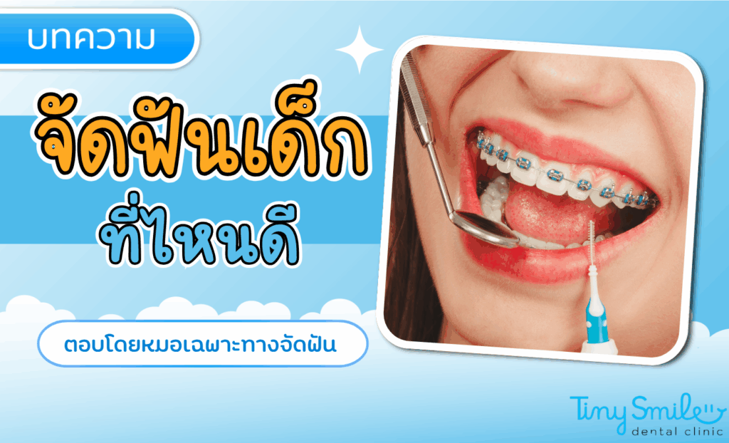 จัดฟันเด็กที่ไหนดี