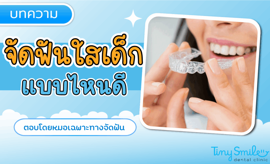 จัดฟันใสสำหรับเด็กมีกี่แบบ รู้จุดเด่นแต่ละตัวเลือกก่อนตัดสินใจ