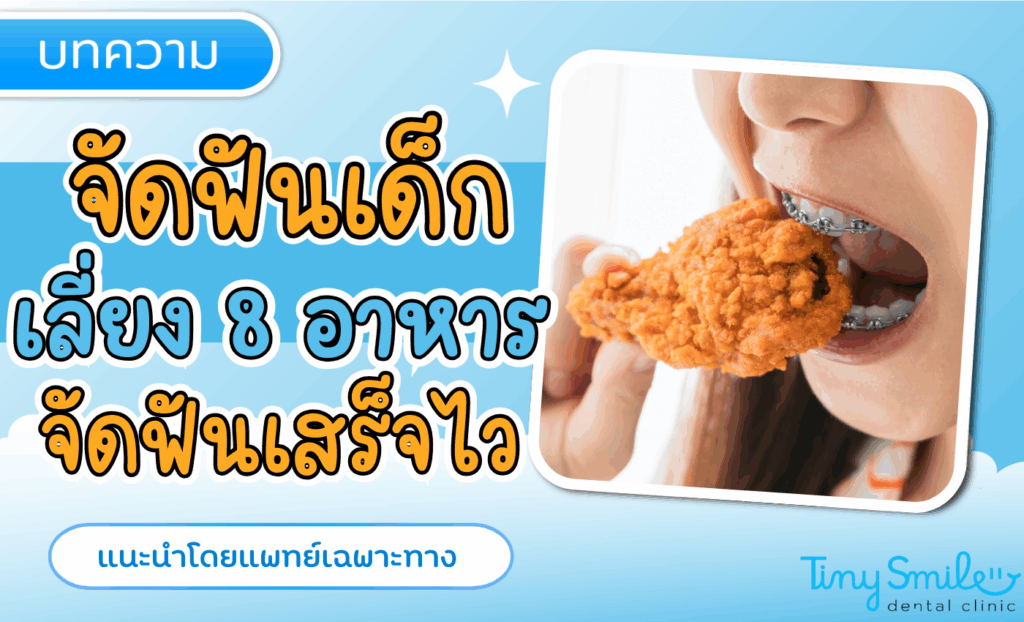 ลูกจัดฟันเด็กเคี้ยวยาก 8 อาหารที่ห้ามกิน พร้อมเมนูทางเลือก รู้แค่นี้