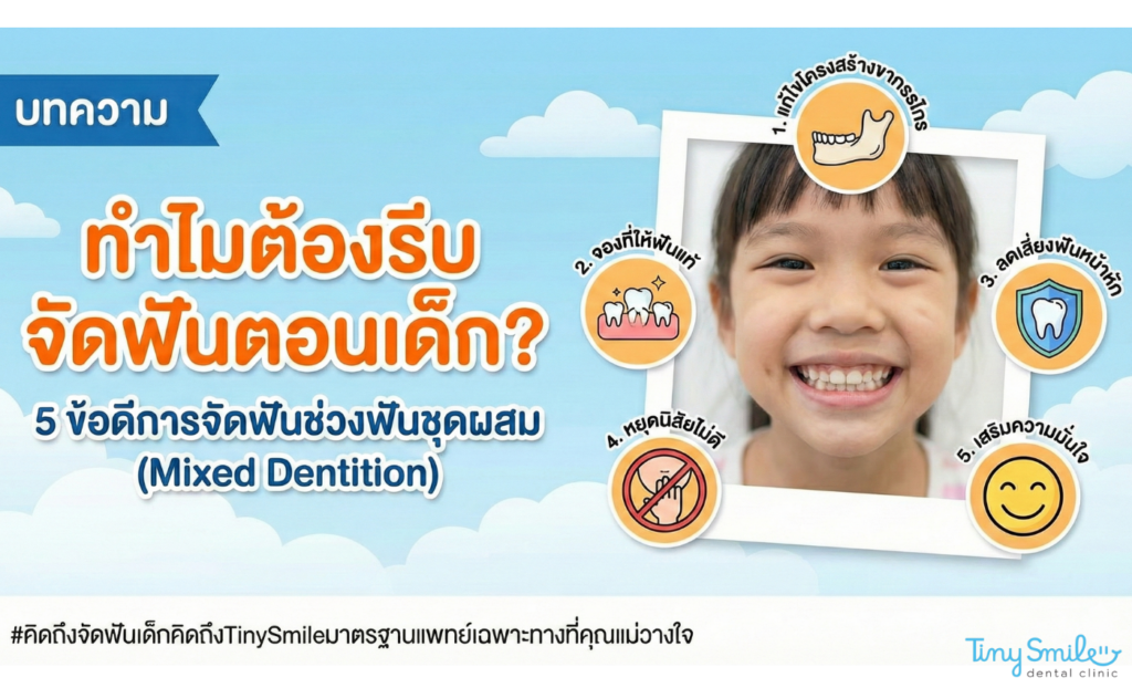 จัดฟันตอนเด็ก 5 ข้อดีการจัดฟันช่วงฟันชุดผสม