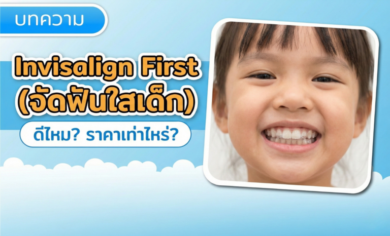 Invisalign First (จัดฟันใสเด็ก) ดีไหม ราคาเท่าไหร่