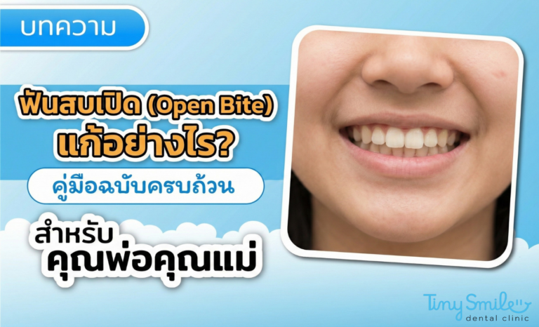 ฟันสบเปิด (Open Bite) กัดเส้นก๋วยเตี๋ยวไม่ขาด แก้ไขอย่างไร