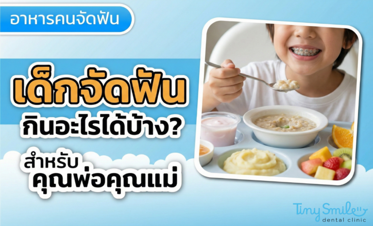 อาหารคนจัดฟัน เด็กจัดฟันกินอะไรได้บ้าง