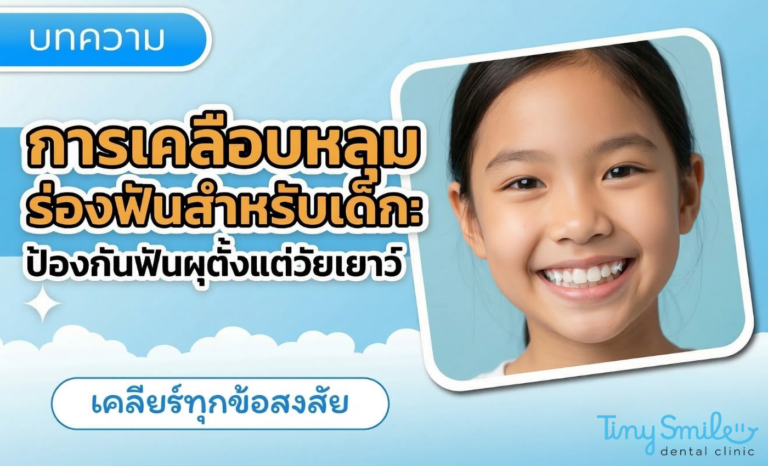 การเคลือบหลุมร่องฟันสำหรับเด็ก ป้องกันฟันผุตั้งแต่วัยเยาว์