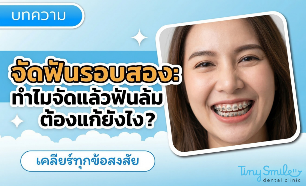 จัดฟันรอบสอง ทำไมจัดแล้วฟันล้ม ต้องแก้ยังไง