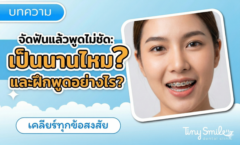 จัดฟันแล้วพูดไม่ชัด เป็นนานไหม และฝึกพูดอย่างไร