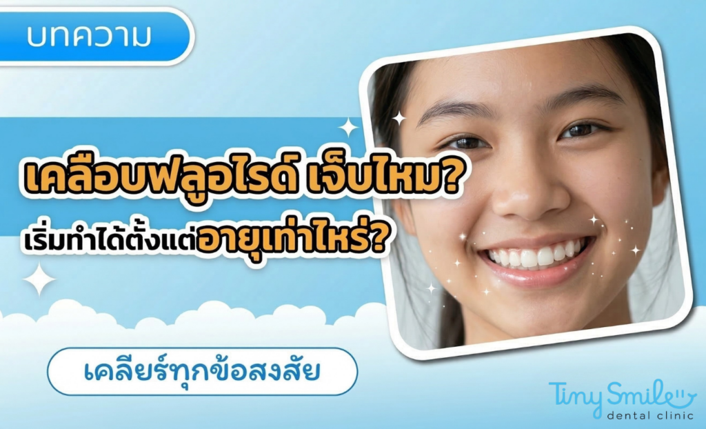 เคลือบฟลูออไรด์เจ็บไหม เริ่มทำได้ตั้งแต่อายุเท่าไหร่