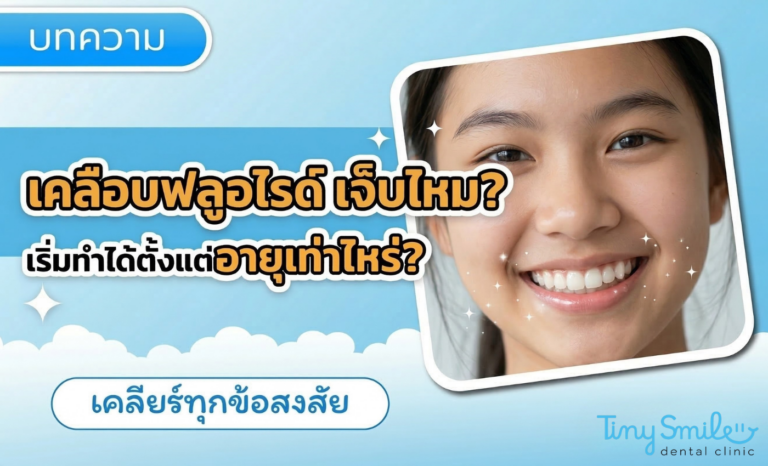 เคลือบฟลูออไรด์เจ็บไหม เริ่มทำได้ตั้งแต่อายุเท่าไหร่
