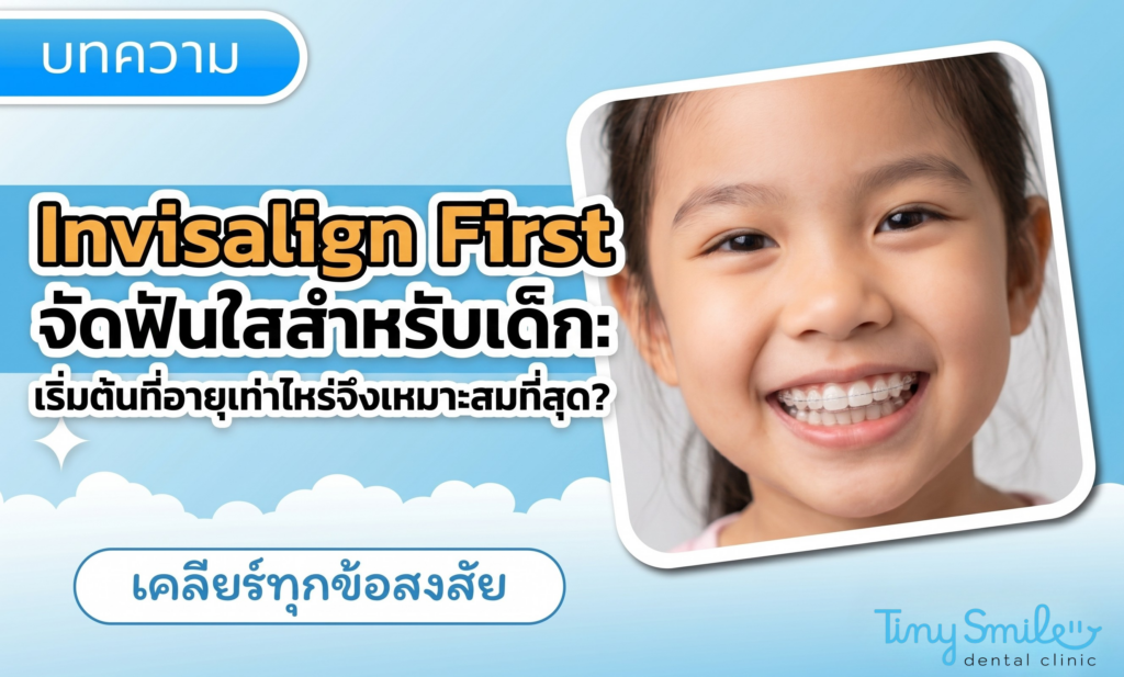 Invisalign First จัดฟันใสสำหรับเด็ก เริ่มต้นที่อายุเท่าไหร่จึงเหมาะสมที่สุด