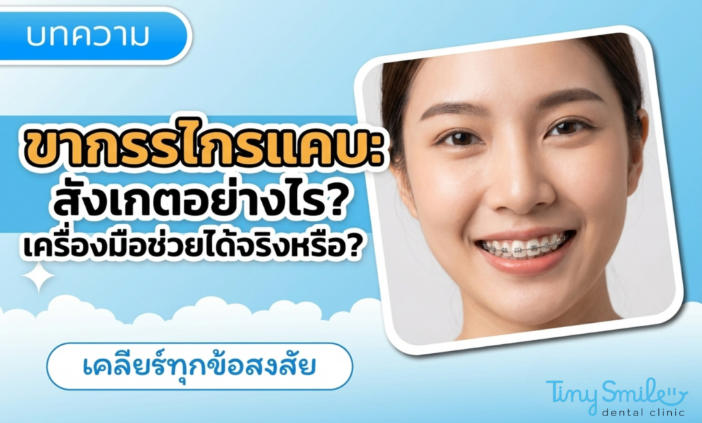 ขากรรไกรแคบ สังเกตอย่างไร และเครื่องมือขยายขากรรไกรช่วยได้จริงไหม