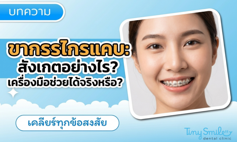 ขากรรไกรแคบ สังเกตอย่างไร และเครื่องมือขยายขากรรไกรช่วยได้จริงไหม