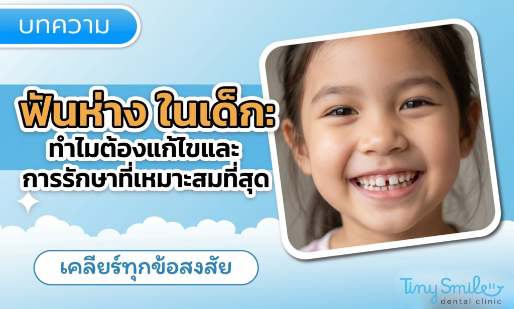 ฟันห่าง ในเด็ก ทำไมต้องแก้ไขและวิธีการรักษาที่เหมาะสมที่สุด