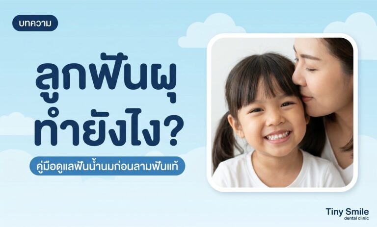 ลูกฟันผุ ทำยังไง คู่มือดูแลฟันน้ำนมก่อนลามฟันแท้ Tiny Smile Dental Clinic
