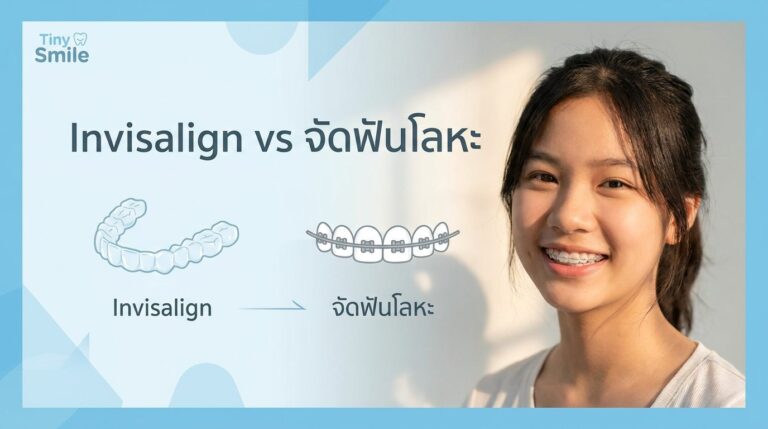 tinysmile-invisalign-vs-metal-cover