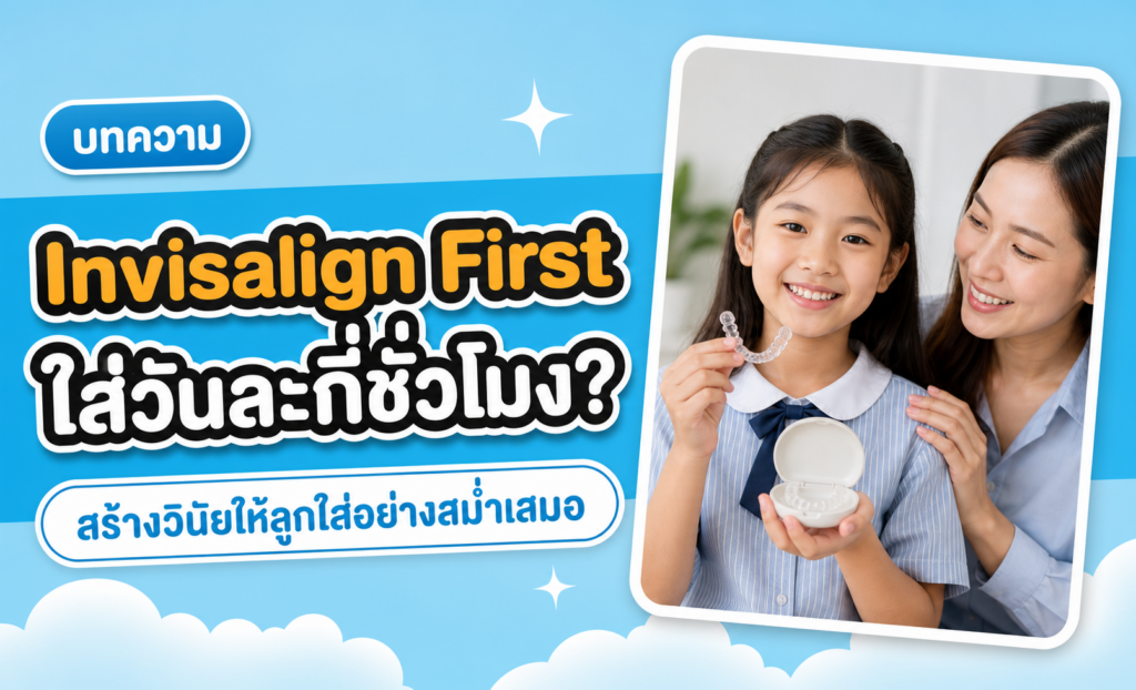 Invisalign First ใส่วันละกี่ชั่วโมง? ช่วยลูกใส่ให้สม่ำเสมอ