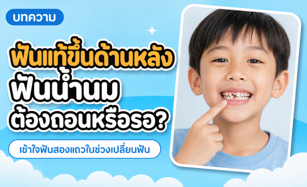 ฟันแท้ขึ้นหลังฟันน้ำนม