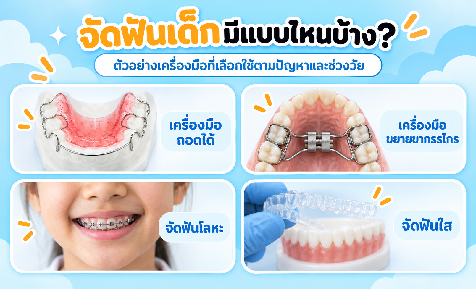 ตัวอย่างประเภทเครื่องมือจัดฟันเด็ก
