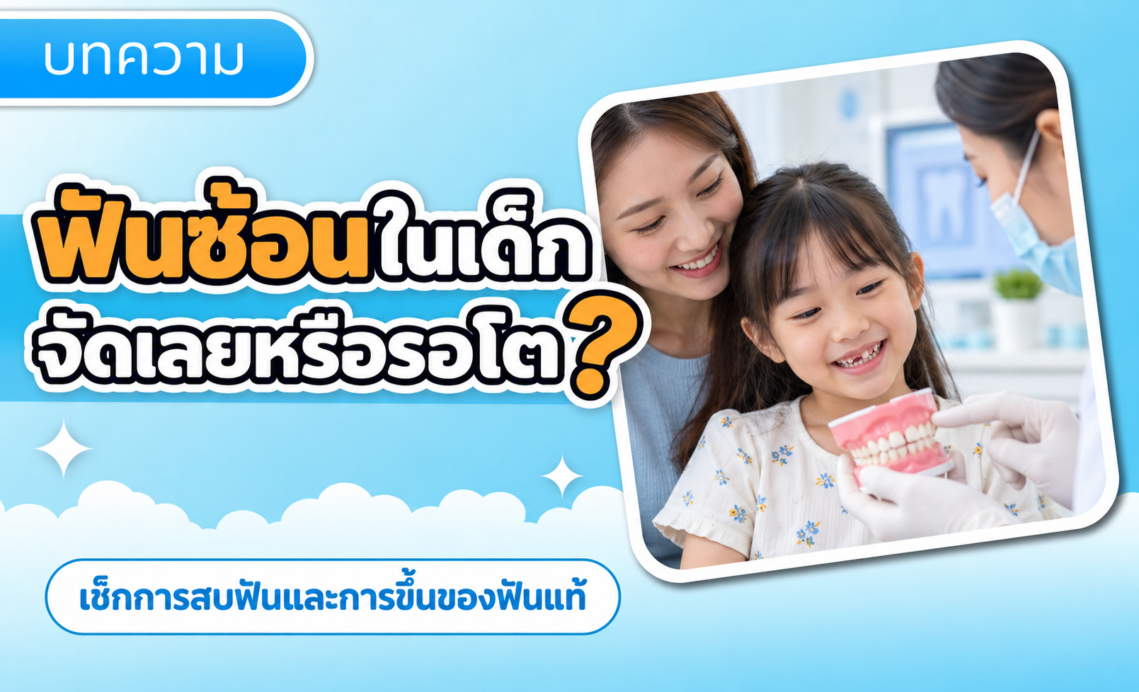 ฟันซ้อนในเด็ก ต้องรีบจัดฟันทันทีหรือรอให้โต? ดู 4 สิ่งก่อนตัดสินใจ