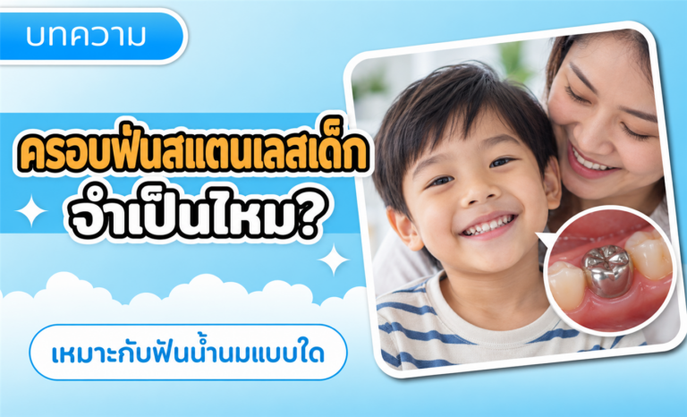 ครอบฟันสแตนเลสเด็ก จำเป็นไหม? เหมาะกับฟันน้ำนมแบบใด